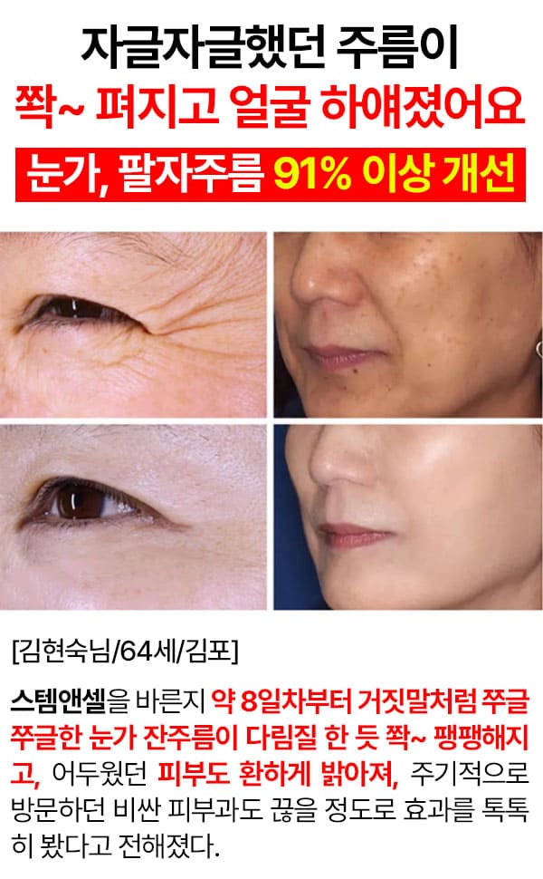 스템엔셀 가격