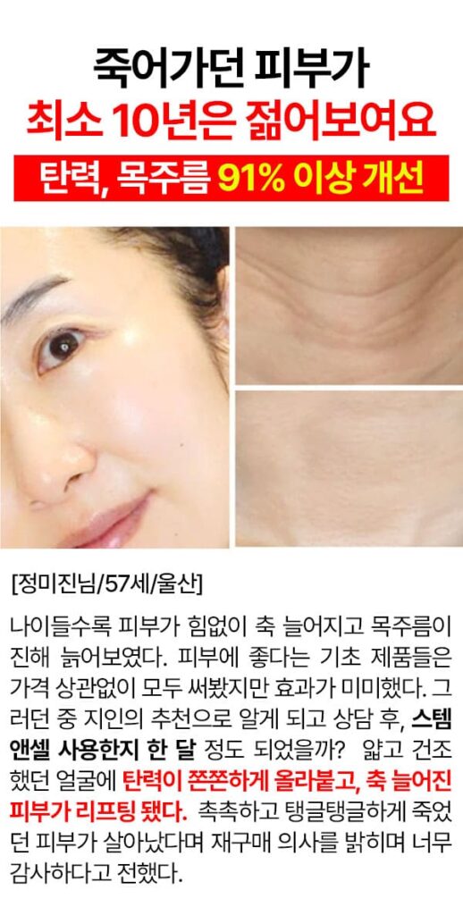 미미셀