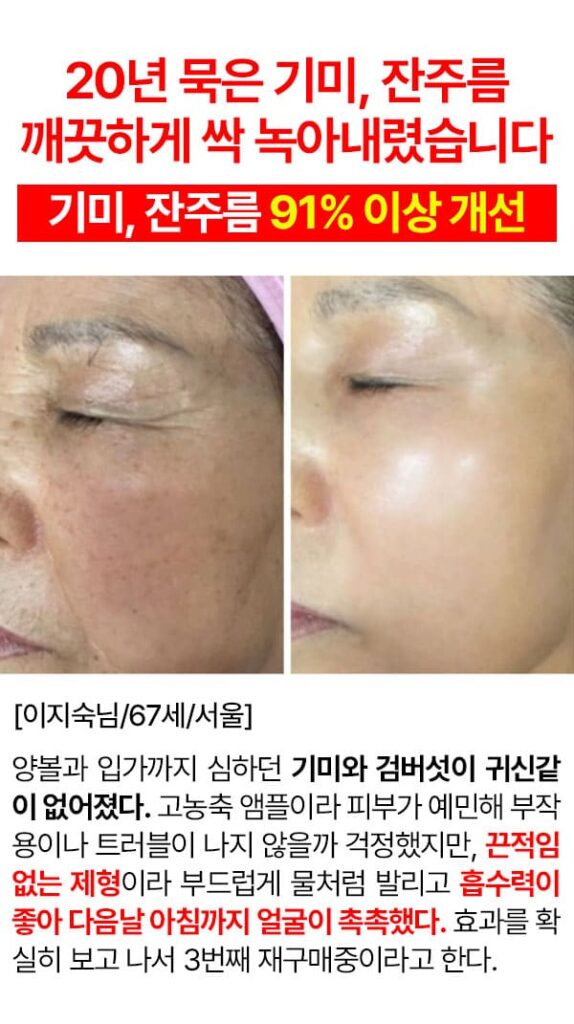 미미셀 후기
