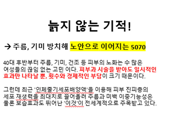 스템엔셀 후기