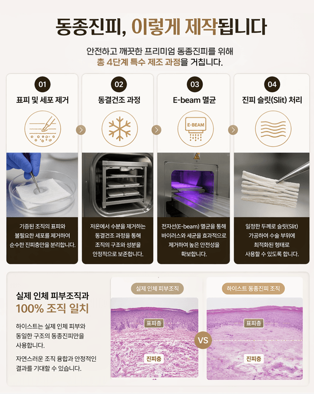 하이스트 비뇨기과 후기