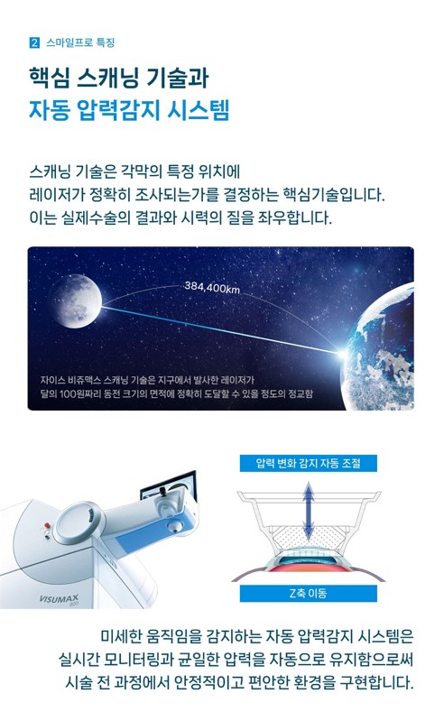 클리어서울안과 백내장