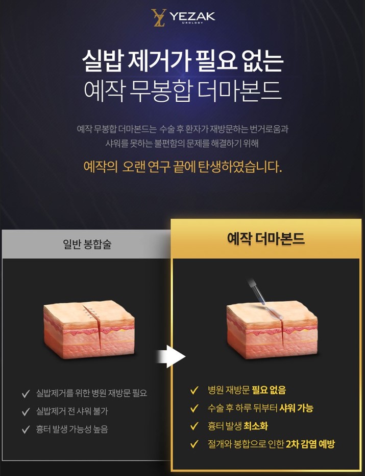 예작비뇨기과 수술 후기
